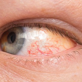 goz hastaliklari ozel netgoz tip merkezi 0 342 322 47 00